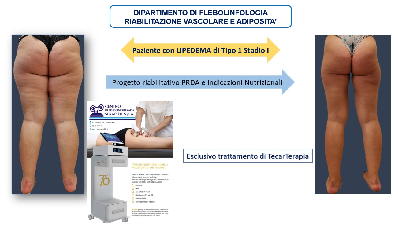 Centro di Fisiocinesiterapia Serapide S.p.A.